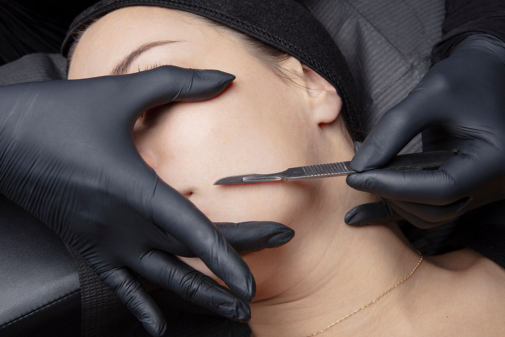 Woman doing dermaplaning